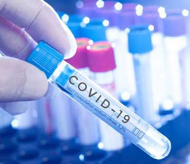 Covid Antigen Test